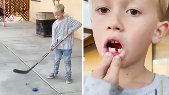 有创意！美国小男孩为纪念换牙 打冰球<em>拔掉</em>松动的<em>牙齿</em>