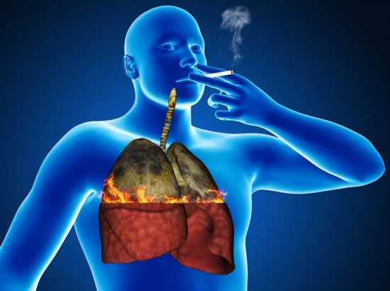 肺癌的咳嗽和别的咳嗽有什么不同？<em>如何辨别自己</em>是否有肺癌征兆...