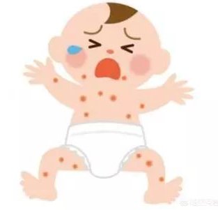 <em>宝宝脸上起了</em>湿疹，发红有小疙瘩，并且还有白皮该怎么办？