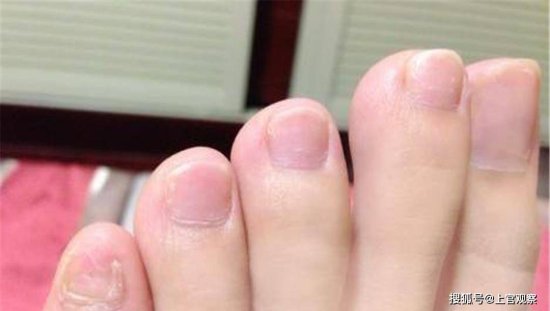 为何有人说，小<em>脚指甲</em>不全的人，是纯种的汉族人呢？