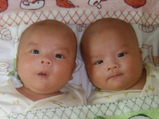 真的<em>好</em>幸运，居然喜得两枚“小少爷”，说说怀双胞胎孕期出现...