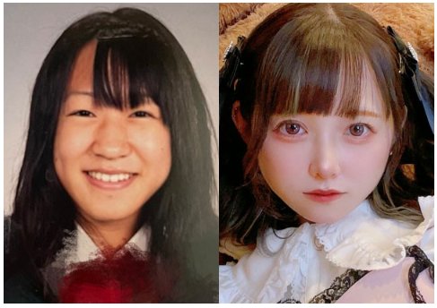 日本妈妈嫌弃女儿丑，9岁就逼去整容！日本小学生整容成灾！