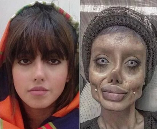 伊朗19岁“<em>僵尸新娘</em>”被判刑10年，伊朗记者求援安吉丽娜朱莉