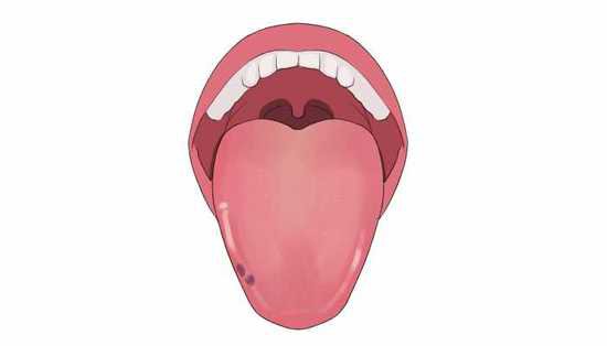 舌头两边锯齿状<em>是什么原因</em> 舌头两边锯齿状是怎么回事