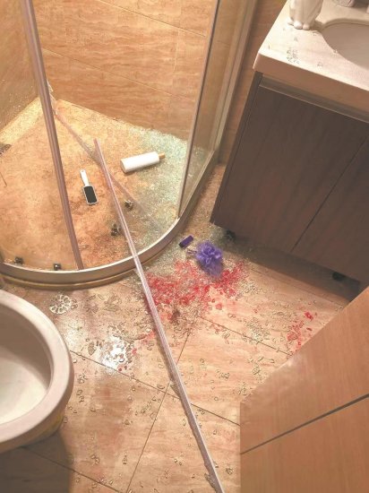精装小区浴室<em>玻璃</em>门遭遇“爆裂门” 两人被碎<em>玻璃</em>划伤