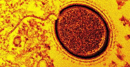 科学家复活48500年前的病毒 听起来<em>恐怖吗</em>