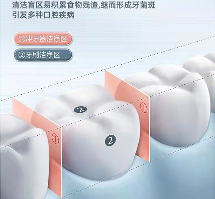 十大冲牙器品牌排行榜：<em>全网收集</em>经典机型！