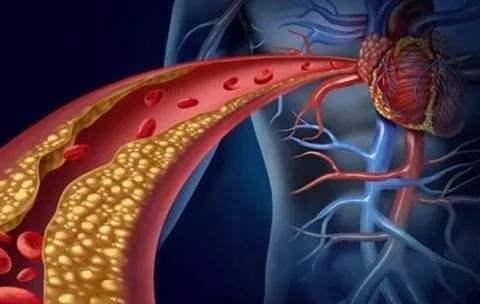 心脏病发作前<em>有哪些前兆</em>和信号？心脏病专家告诉您答案！