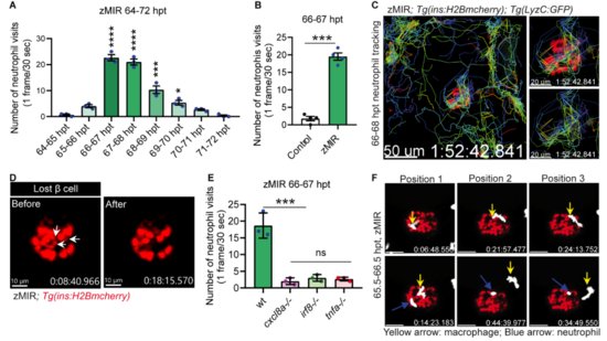 陈文标团队揭示巨噬细胞和中性粒细胞参与营养过剩诱导胰岛β...
