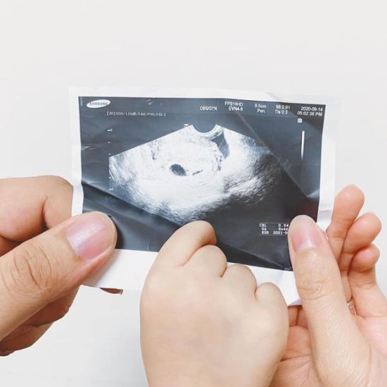 怀孕，二宝日记：怀孕征兆？孕<em>初期</em>的身体变化！