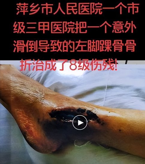 江西萍乡市人民医院敷衍推诿病患造成医疗损害